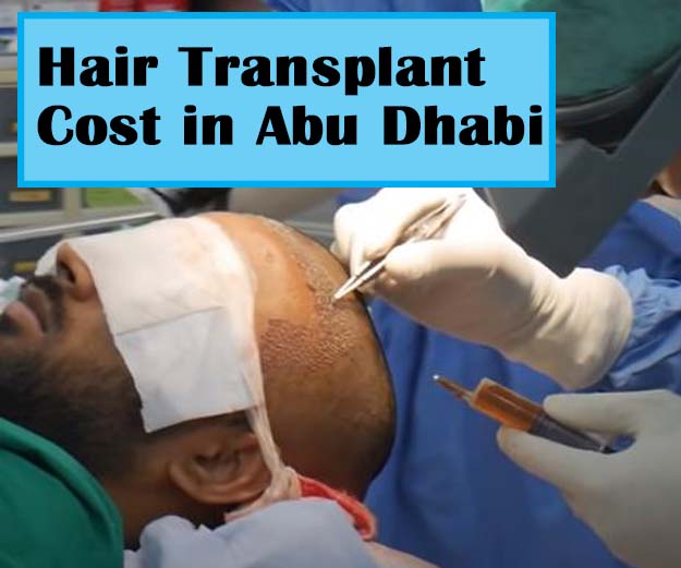 3 Best Hair Transplant Clinics in Abu Dhabi: Apollo, Kaya, Cosmesurge - UAE  INSURE